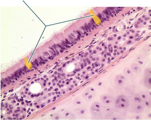 Which Structures Are Highlighted? Which Structures Are Highlighted? Goblet Cells Submucosa Chondrocytes