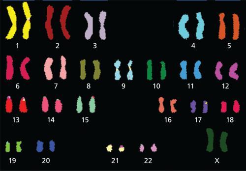 The Karyotype Below Was Obtained From A Human Cell. Based On The Chromosome Spread, What Cell Type Could