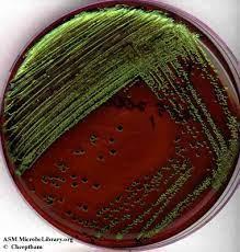 Is This A E. Coli From A EMB Media? Im Not Sure 