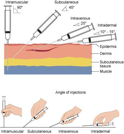 Explain The Difference Between Intravenous, Intramuscular And Subcutaneous Injections.