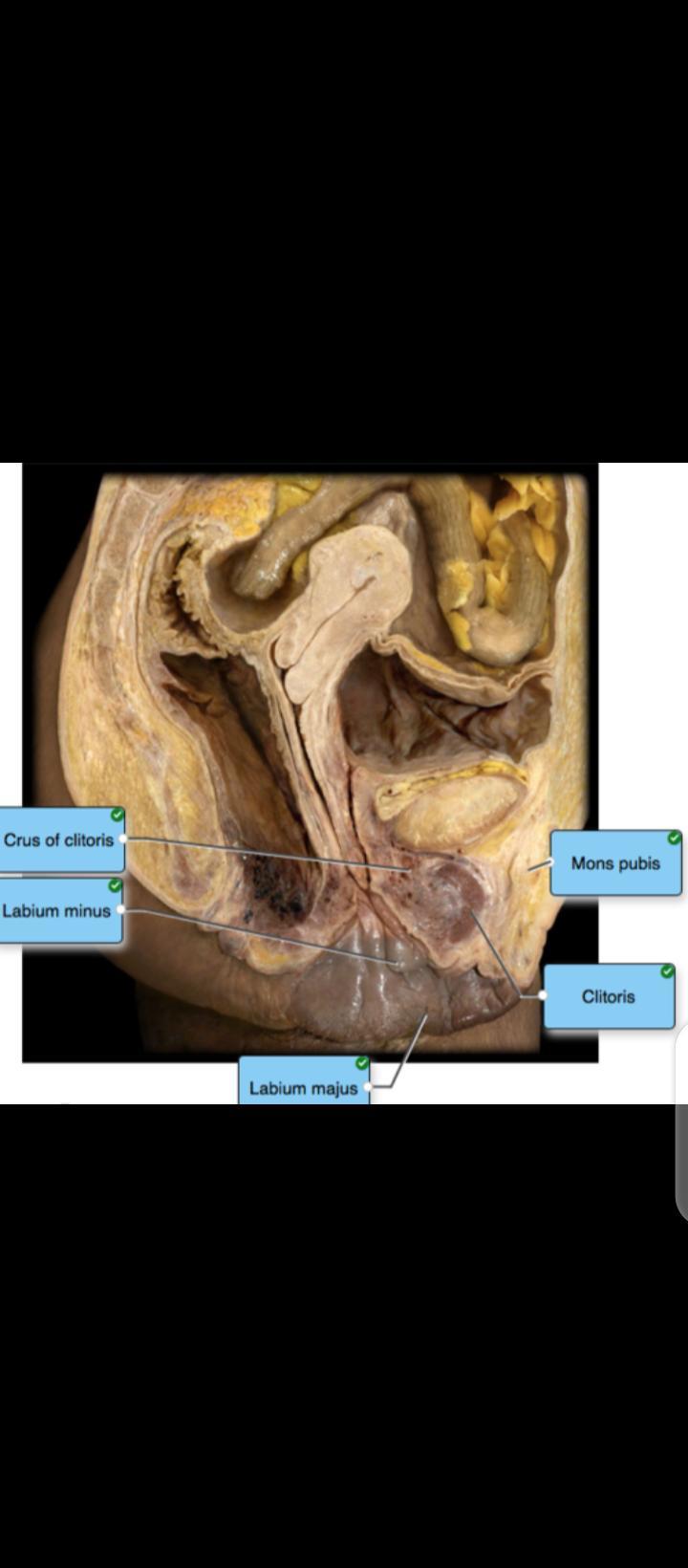 Label The Reproductive Structures Of The Female Pelvis Using The Hints Provided.
