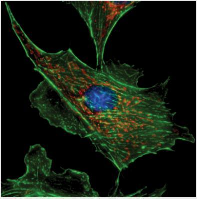 Which Statement Is True About Fibroblasts? They Are A Type Of Cell That Can Be Found In ET. They Prevent