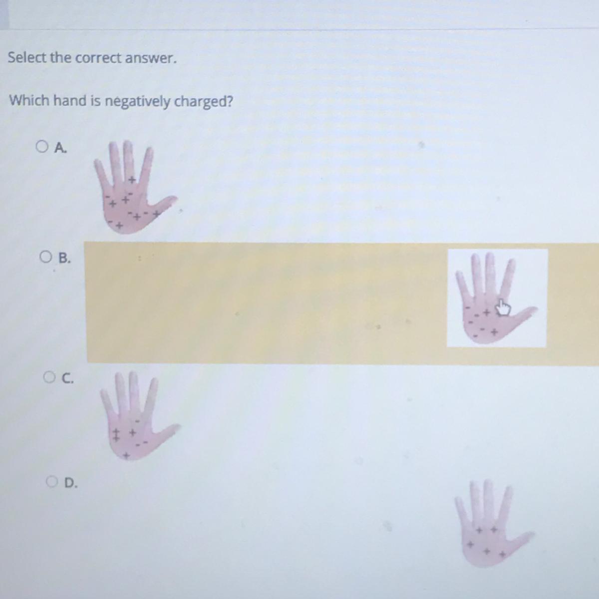 Which Hand Is Negatively Changed?A.B.C.D.