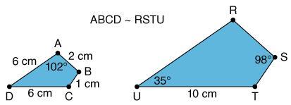 What Is The Length Of RU ?A) 5 CmB) 10 CmC) 6 CmD) 8 Cm