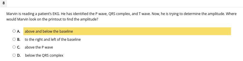 Marvin Is Reading A Patients EKG. He Has Identified The P Wave, QRS Complex, And T Wave. Now, He Is Trying