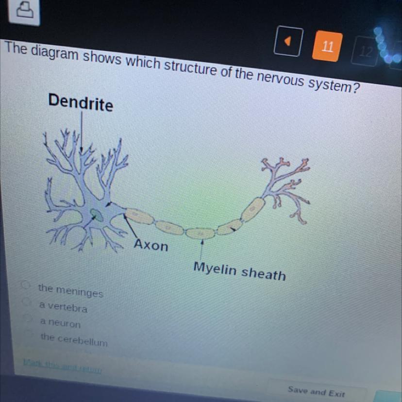 The Diagram Shows Which Structure Of The Nervous System?DendriteAxonMyelin Sheaththe Meningesa Vertebraa