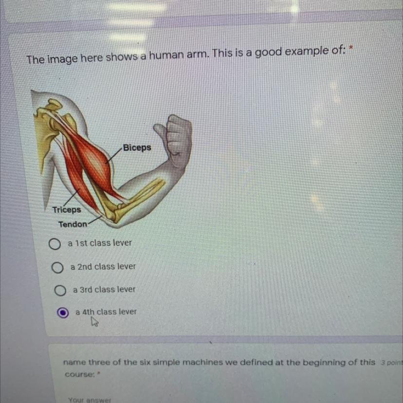 1 PointThe Image Here Shows A Human Arm. This Is A Good Example Of:BicepsTricepsTendona 1st Class Levera