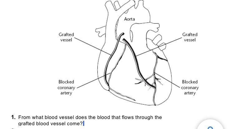 From What Blood Vessel Does The Blood That Flows Through Thegrafted Blood Vessel Come?