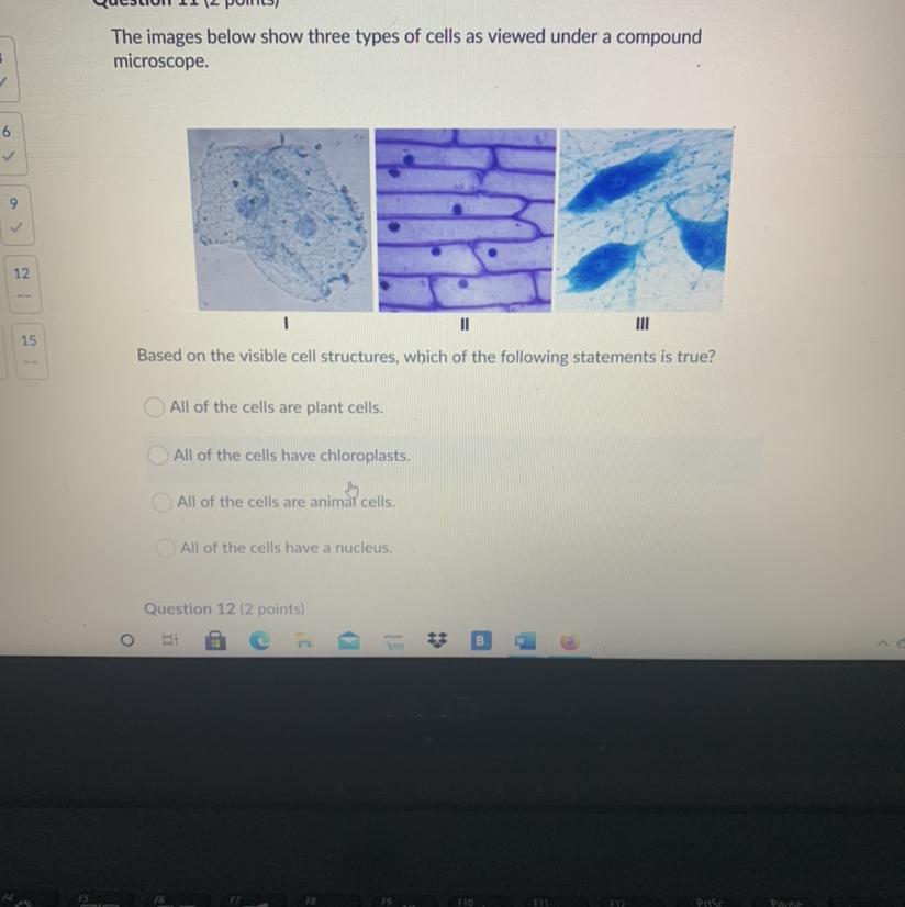 Based On The Visible Cell Structure, Which Of The Following Statements Is True? 