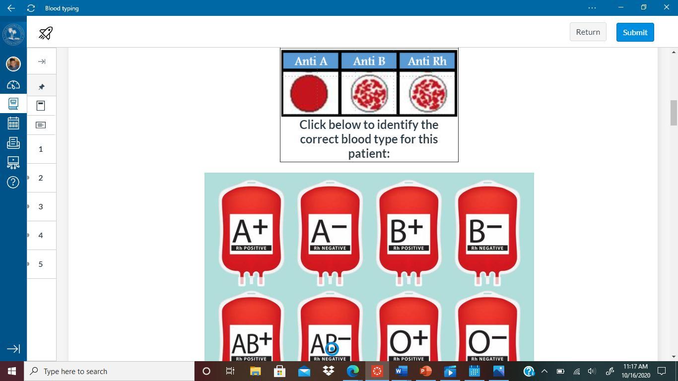 What The Difference Between The One With The Red Dot And The One With The Solid Red. Explain The Whole