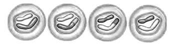 what stage of meiosis is seen here:telophasetelophase 1telophase 2interphase